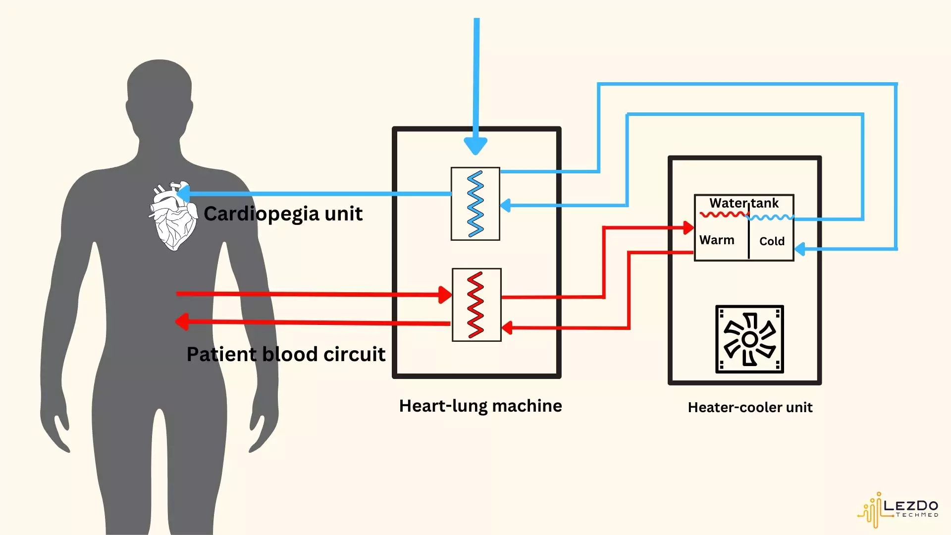 heater-cooler-infection-picture-shows-heater-cooler-device