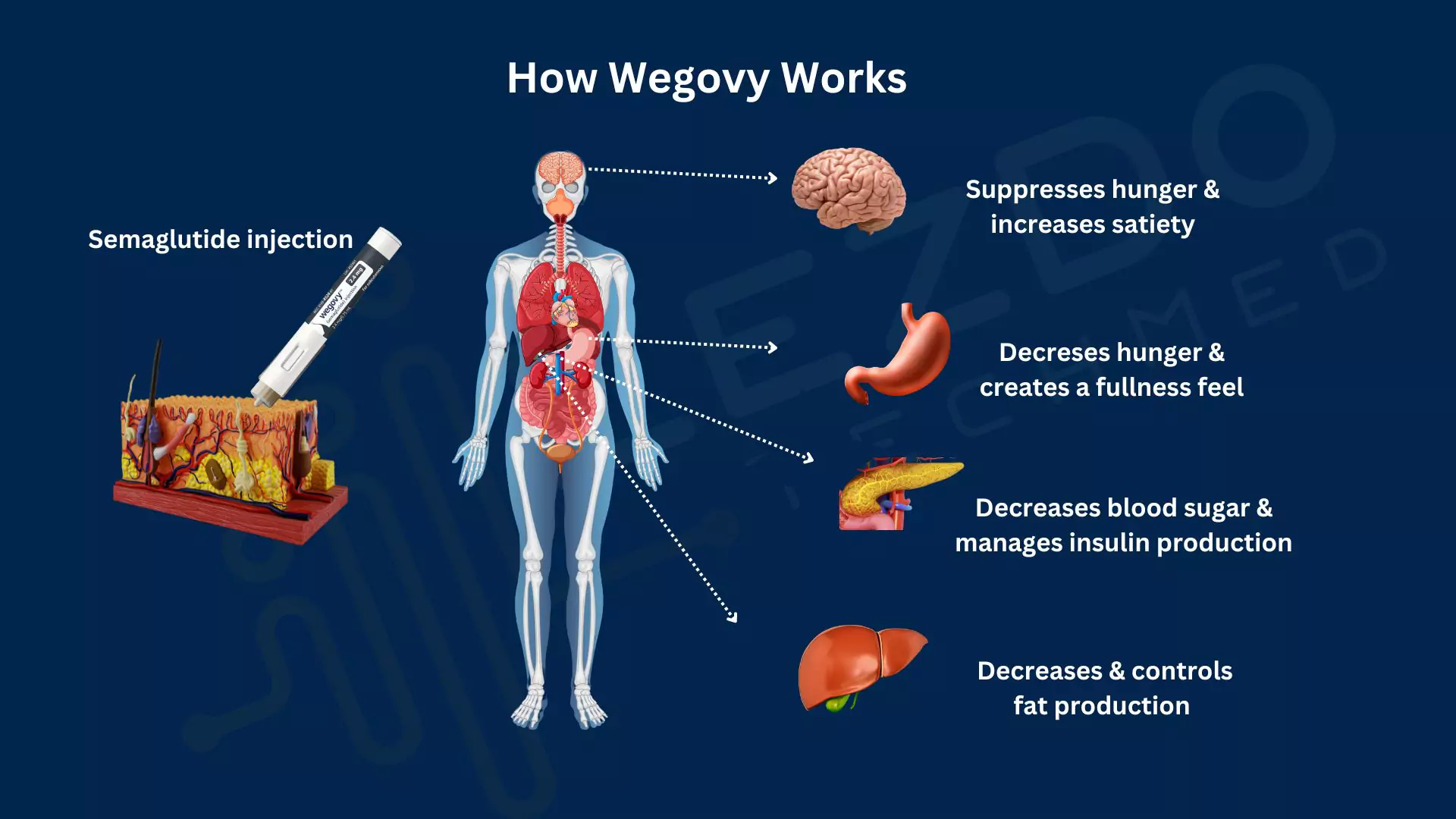 know-how-wegovy-works